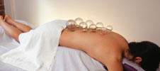 Woman laying on her stomach receiving cupping.