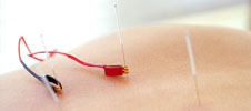 Electro-acupuncture